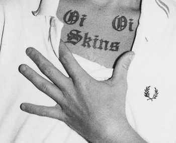 skins